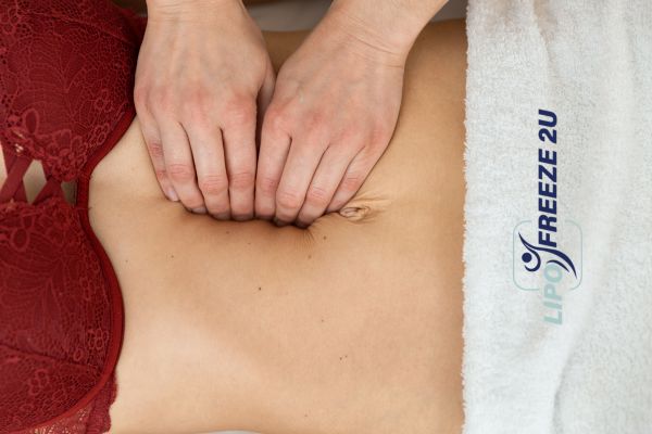 diastasis recti treatment Stoke-on-Trent