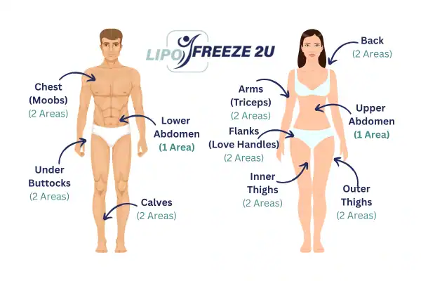 Areas you can have fat freezing treatment Stoke-on-Trent