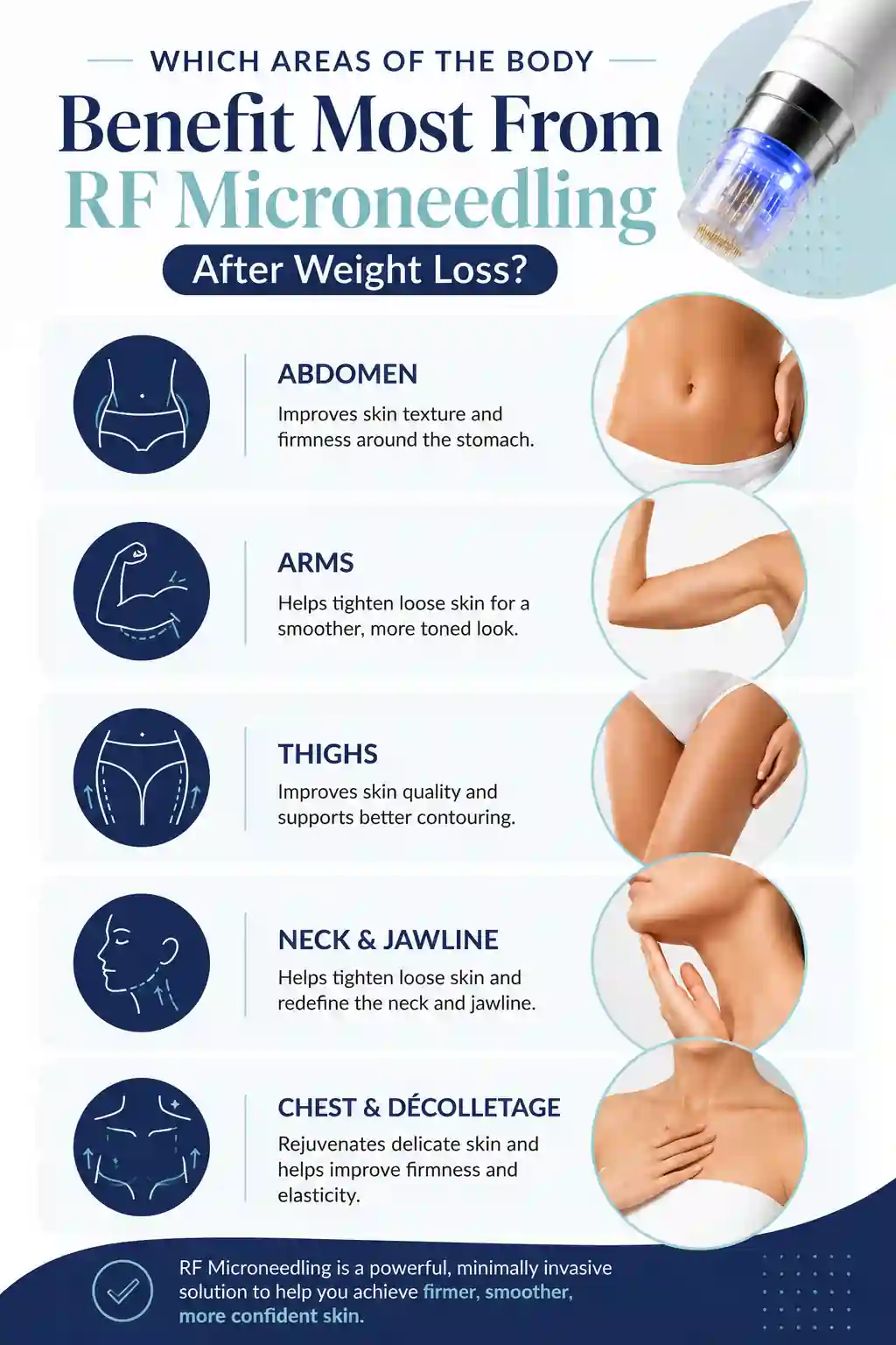 Which Areas of the Body Benefit Most From RF Microneedling After Weight Loss Stoke-on-Trent